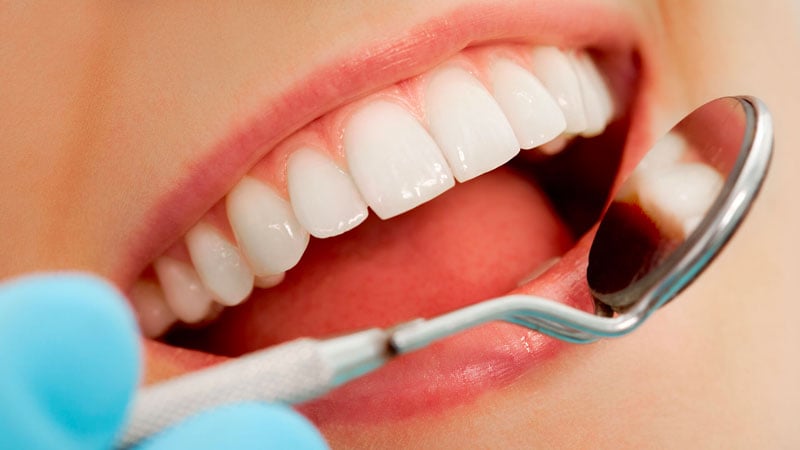 couronne dentaire hongrie 2 | Clinique Jildent